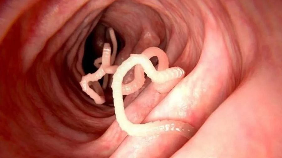 parasita no intestino